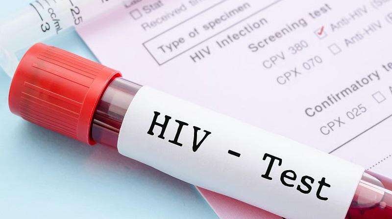 Mawas Diri, Dinas Kesehatan Riau Temukan 11.336 Kasus HIV dan 6.990 Pasien Masih Bertahan